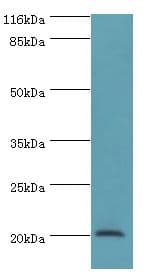 def / Peptide deformylase Antibody (aa2-169)