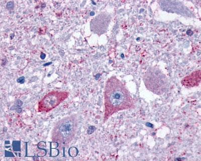 PathPlus™ Polyclonal Rabbit anti-Human GPR4 Antibody (Extracellular Domain, IHC)