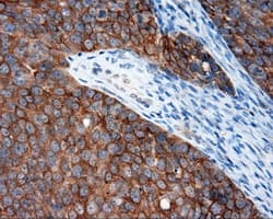 Monoclonal Mouse anti-Human RIP1 / RALBP1 Antibody (clone OTI1E2, IHC, IF, WB)
