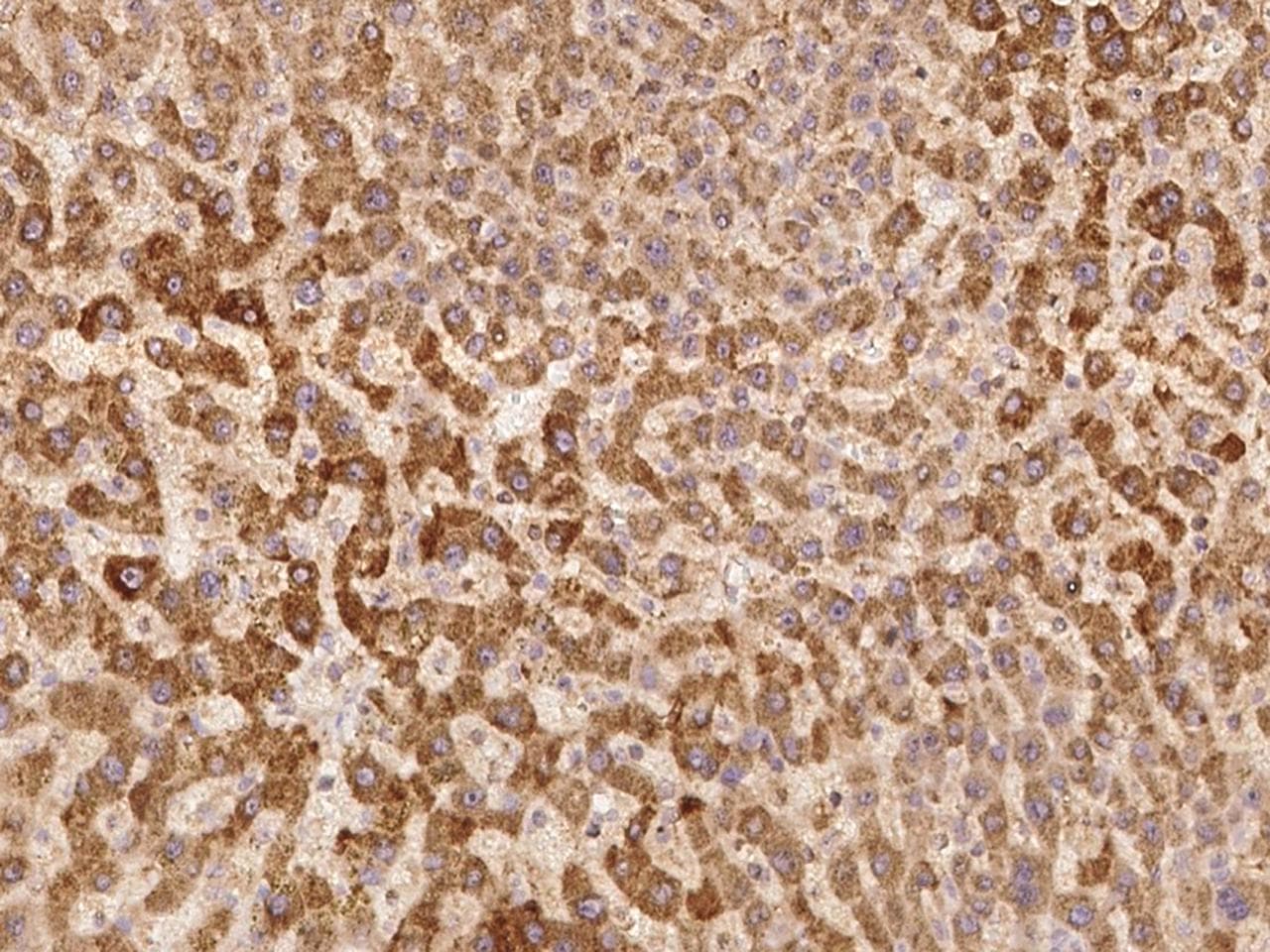 ZNF101 Antibody