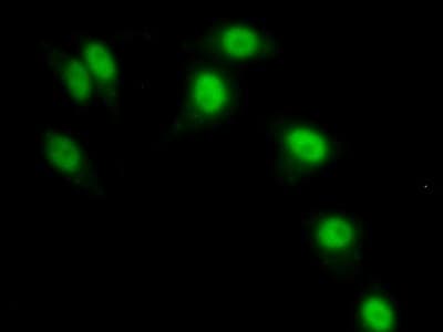 BM022 / MRPL1 Antibody (aa147-285)