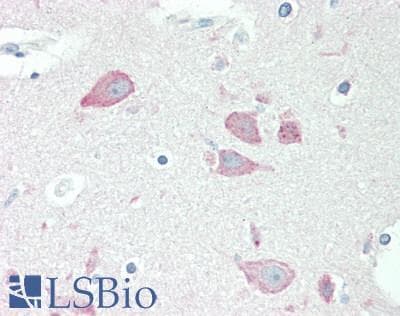 PathPlus™ Polyclonal Goat anti-Human Neuroserpin Antibody (aa399-410, IHC, WB)