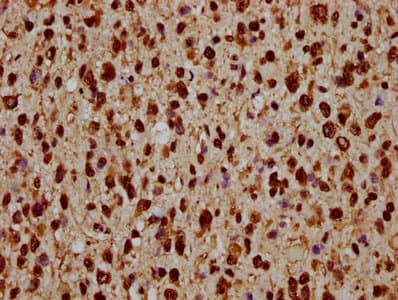 HIST1H1C Antibody