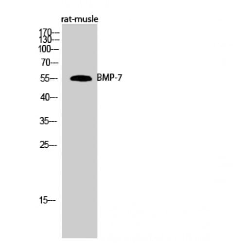 Polyclonal Rabbit anti-Human BMP7 Antibody (Internal, IHC, WB)