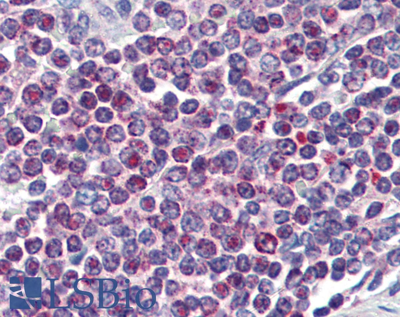 IHC-plus™ NFATC1 / NFAT2 Antibody (aa428-716, clone AT1C3)