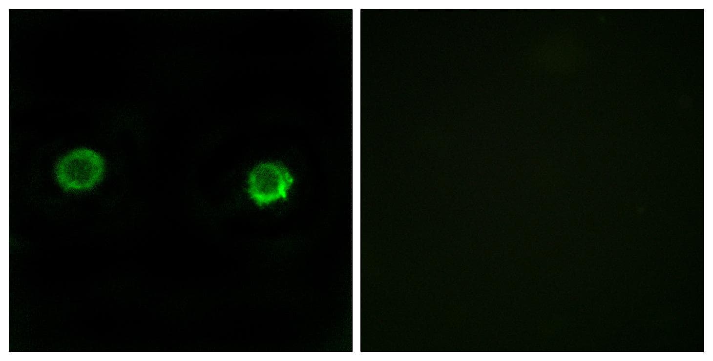 ABHD2 Antibody