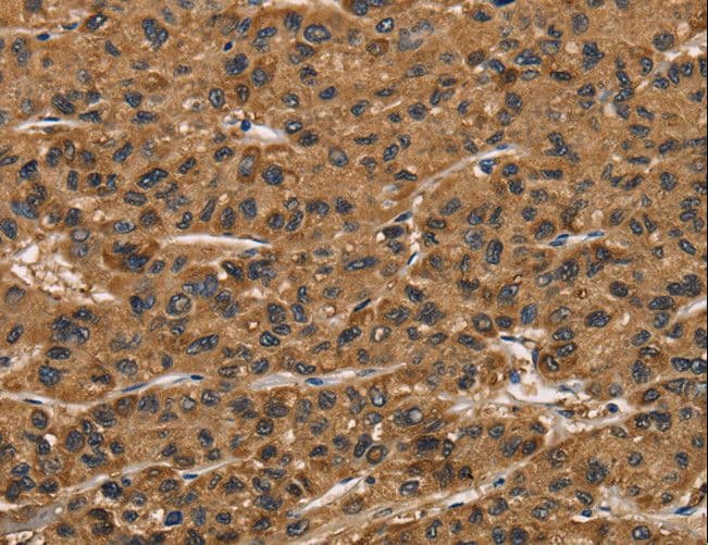 MNK / ATP7A Antibody