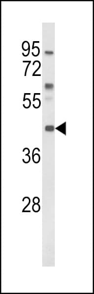 IHC-plus™ MC3R / MC3 Receptor Antibody (aa86-112)