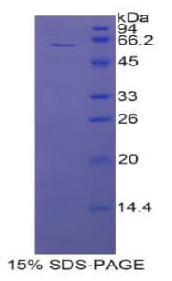 Rat AIM / CD5L Protein (Recombinant His-GST)