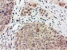 SMS / Spermine Synthase Antibody (clone OTI2G8)