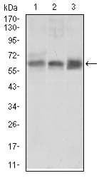 IHC-plus™ ALK3 / BMPR1A Antibody (aa179-378, clone 4B7B2)