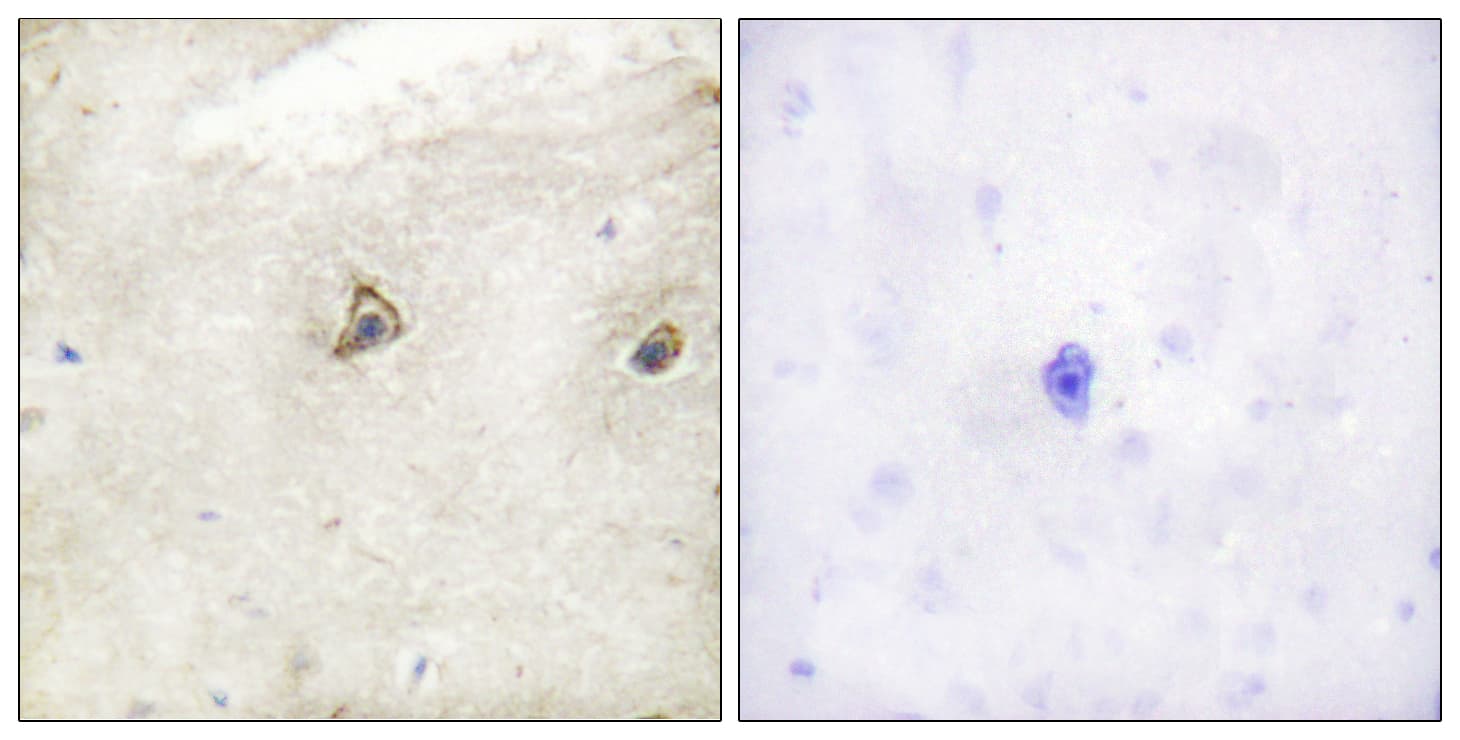 ABL1 / c-ABL Antibody (aa196-245)