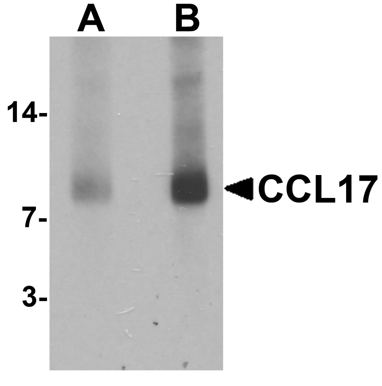 CCL17 / TARC Antibody
