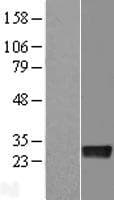 DENR / Density Regulated Protein (Over-Expression Lysate Myc-DDK (Flag))