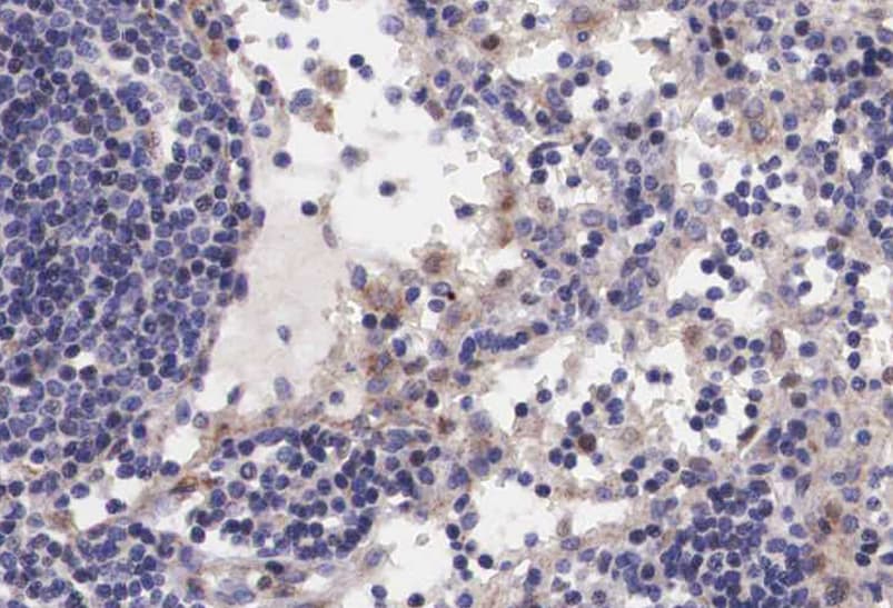 RAF1 / RAF Antibody (phospho-Ser621)