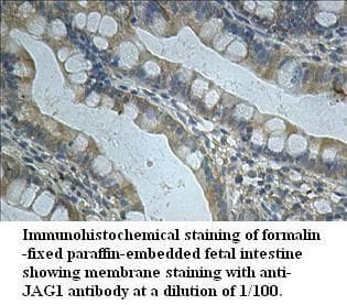 Polyclonal Rabbit anti-Human JAG1 / Jagged 1 Antibody (aa469-746, IHC)