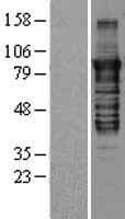 Human PRKCE / PKC-Epsilon Protein (Over-Expression Lysate Myc-DDK (Flag))