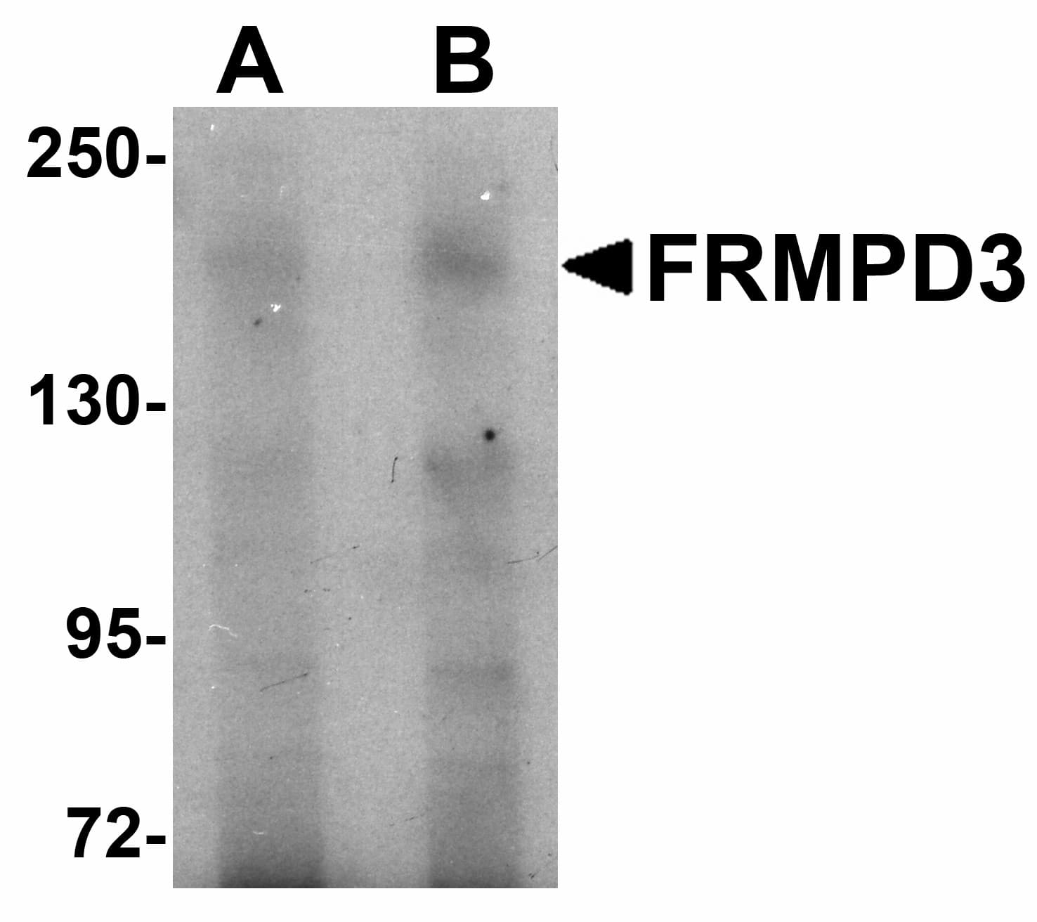 IHC-plus™ Polyclonal Rabbit anti-Human FRMPD3 Antibody (IHC, IF, WB)