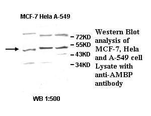 Polyclonal Rabbit anti-Human AMBP Antibody (aa2-250, IHC, WB)