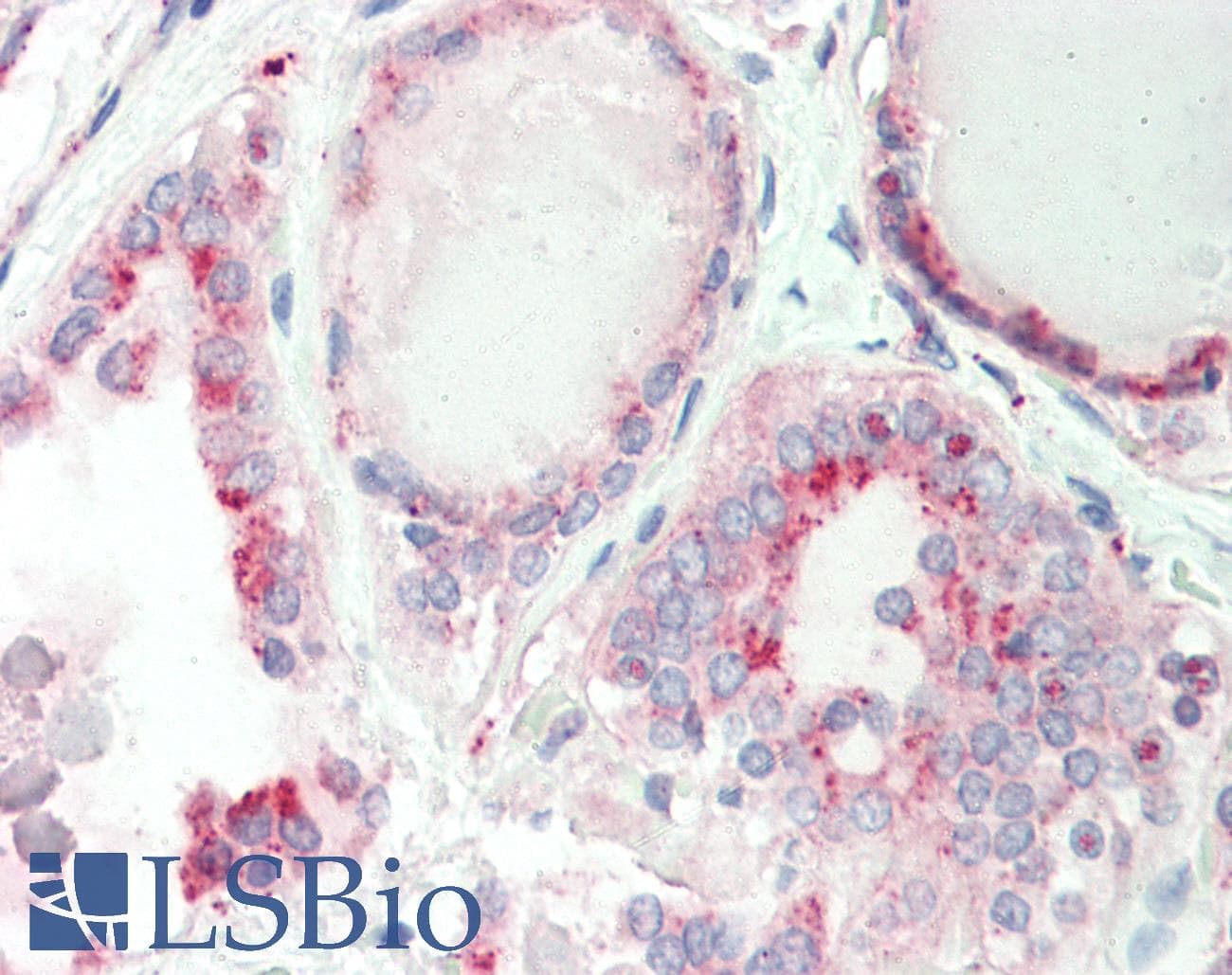 GATAD1 Antibody (C-Terminus)