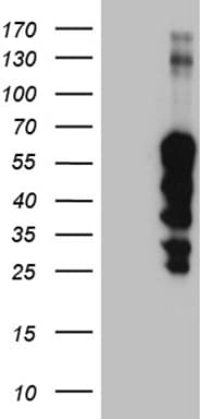ZNF213 Antibody (aa1-292, clone OTI3D3, Carrier-free)