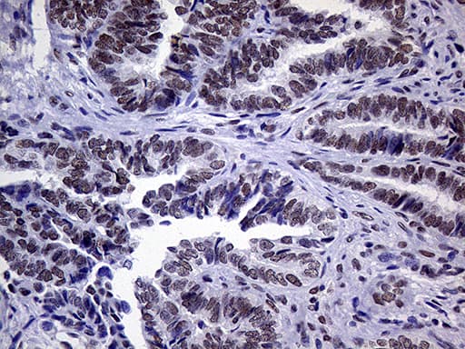 ERCC3 / XPB Antibody (aa191-436, clone OTI6H8)