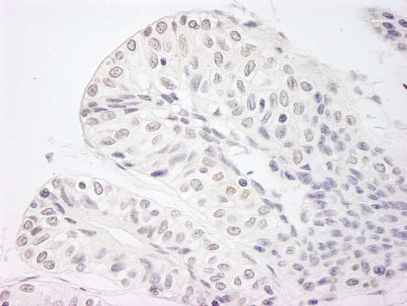Polyclonal Rabbit anti-Human KDM5A / JARID1A Antibody (aa1640-1690, IHC)