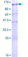 Human RBM12 Protein (Recombinant GST)
