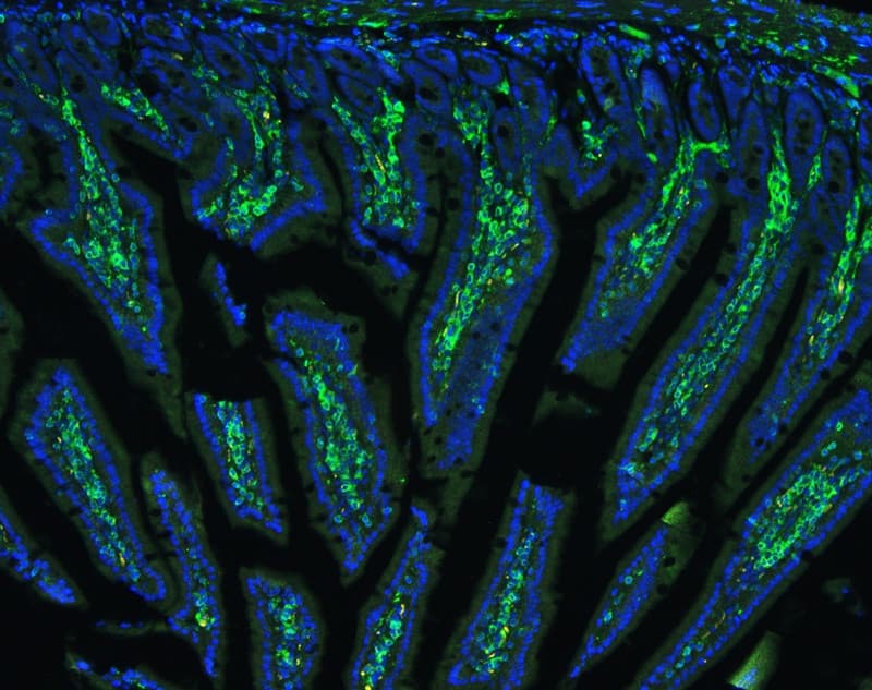 Polyclonal Rabbit anti-Human ANXA6/Annexin A6/Annexin VI Antibody (IHC, WB)