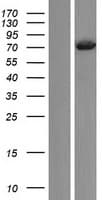 Human PLS3 / T Plastin Protein (Over-Expression Lysate Myc-DDK (Flag))