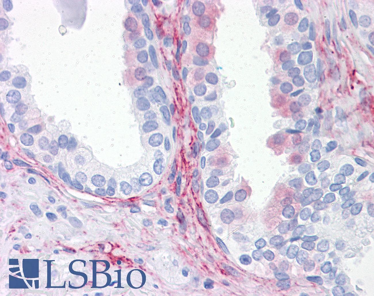 IHC-plus™ Monoclonal Mouse anti-Human AQP8 / Aquaporin 8 Antibody (clone 1F8, IHC, WB)