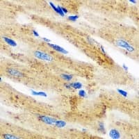SGCE Antibody