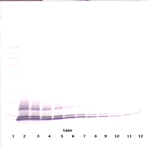 Polyclonal Rabbit anti-Human CCL14 Antibody (WB)