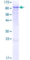 Human HAL / Histidine Ammonium Lyase Protein (Recombinant GST)