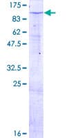 Human ZNF585B Protein (Recombinant GST)