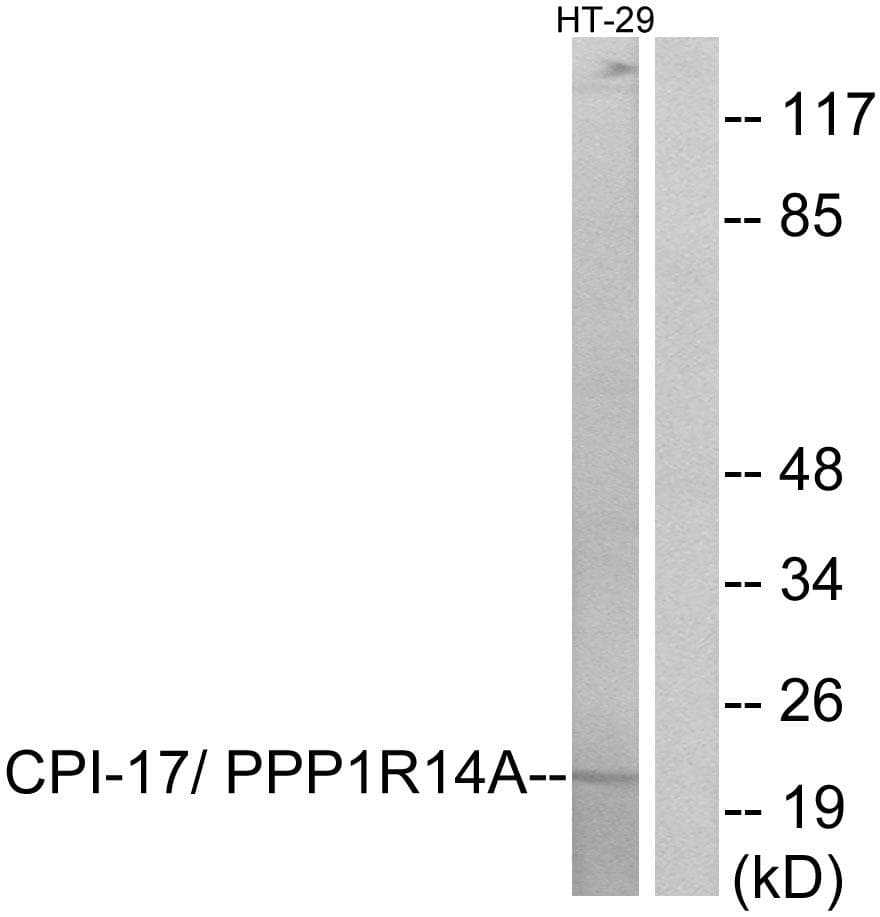 PPP1R14A / CPI-17 Antibody (p38)