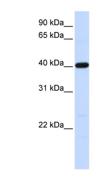 Polyclonal Rabbit anti-Human TMOD3 / Tropomodulin 3 Antibody (aa36-85, WB)