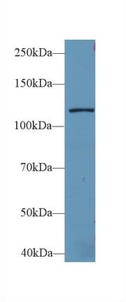 LARS / Leucyl-TRNA Synthetase Antibody
