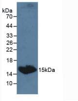 TSHB / TSH-Beta Antibody (aa20-138, PE)