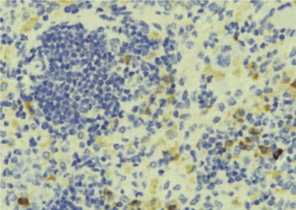 Polyclonal Rabbit anti-Human PTP4A1 / PRL-1 Antibody (IHC, IF, WB)