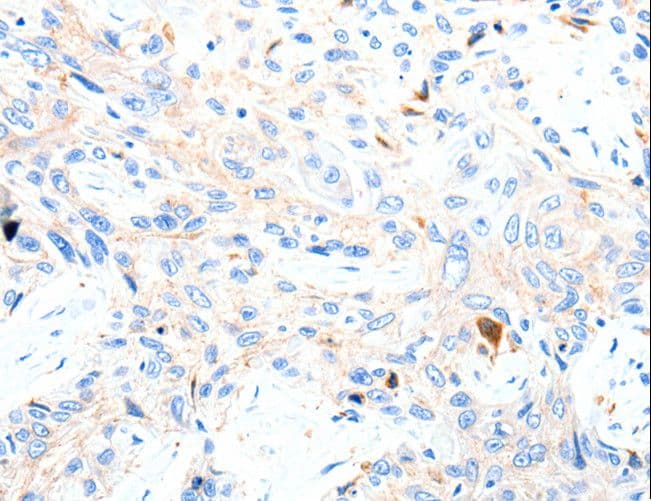 Polyclonal Rabbit anti-Human P2RY1 / P2Y1 Antibody (IHC)