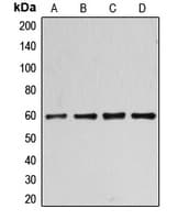 Polyclonal Rabbit anti-Human CCNB1 / Cyclin B1 Antibody (phospho-Ser126, IHC, WB)