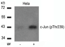 Polyclonal Rabbit anti-Human JUN / c-Jun Antibody (IHC, WB)