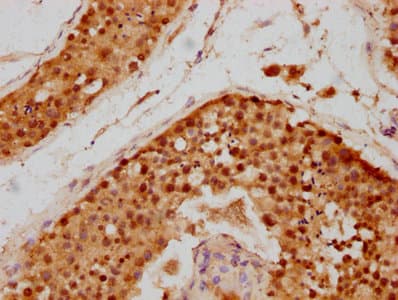 Polyclonal Rabbit anti-Human SIVA1 / SIVA Antibody (aa1-110, WB)