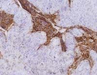 Monoclonal Mouse anti-Human CEACAM5 / CD66e Antibody (clone CB30, IHC)