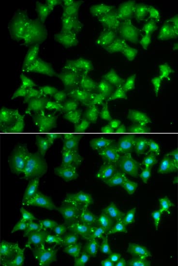 ELF3 / ESE1 Antibody
