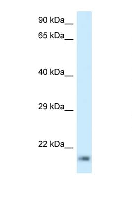 RPL23A Antibody (C-Terminus)