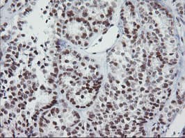 Monoclonal Mouse anti-Human KIF25 Antibody (clone OTI2D6, IHC, WB)