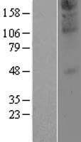 ZDHHC21 Protein (Over-Expression Lysate Myc-DDK (Flag))