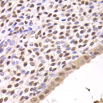 FKBP4 / FKBP52 Antibody